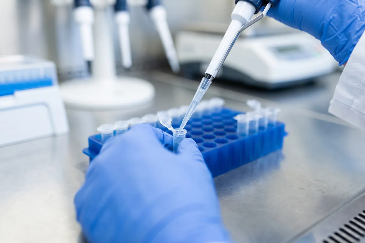 Laboratory technician pipetting blood samples